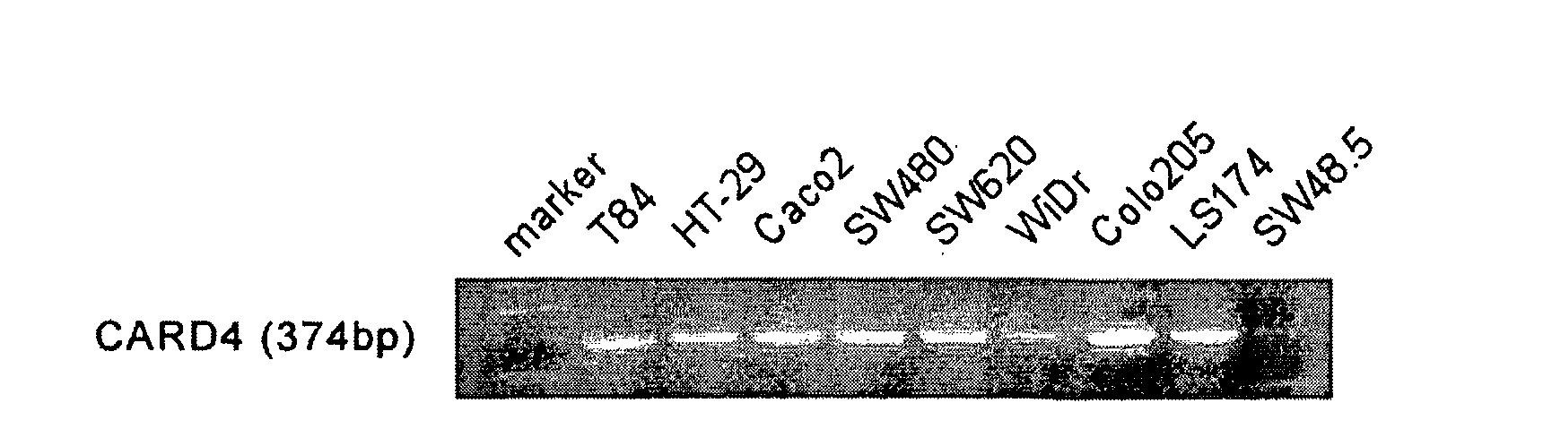 Compositions And Methods Related To An Intestinal Inflammation And Uses Therefor