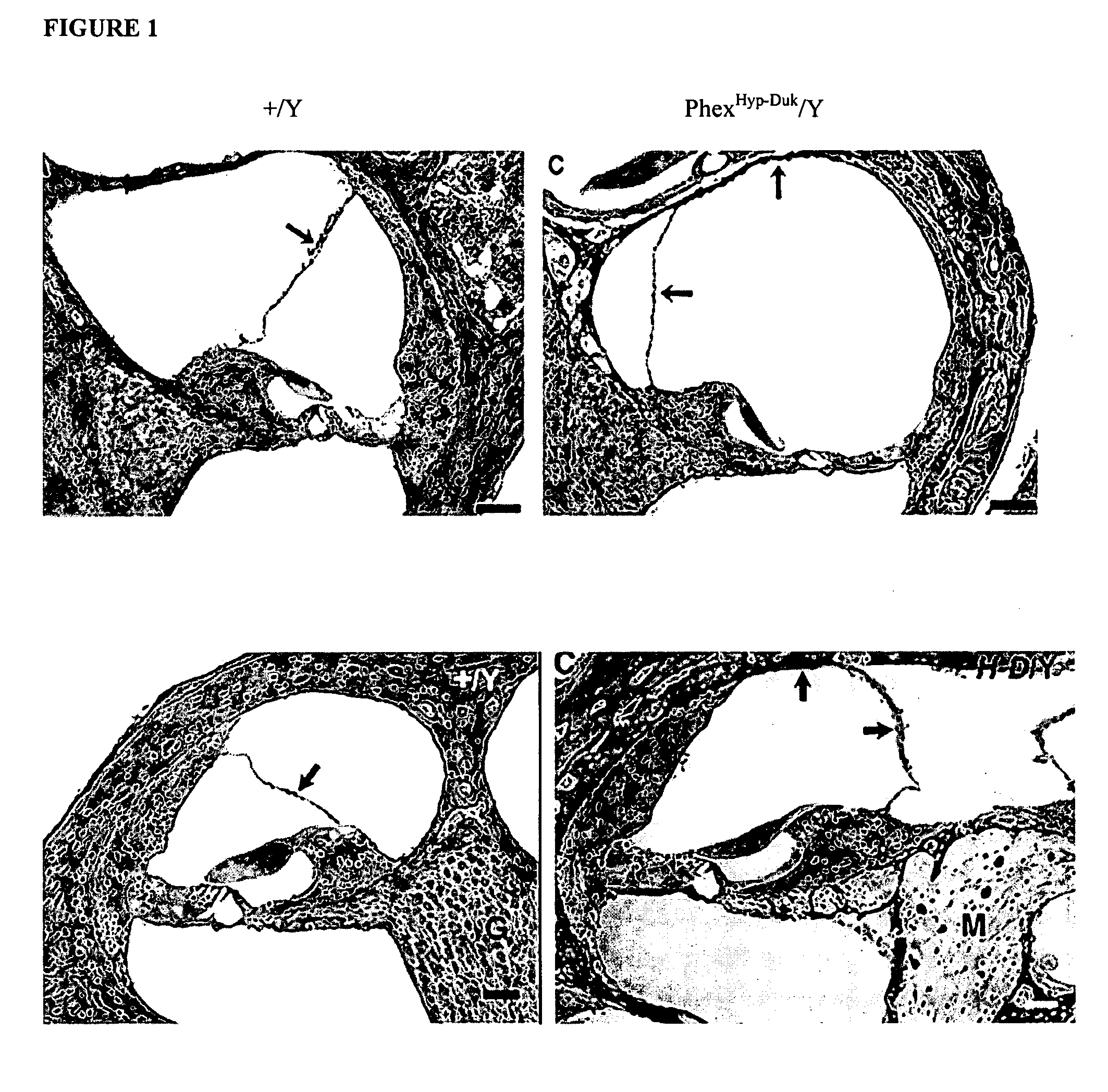 Methods and compositions for neuroprotection