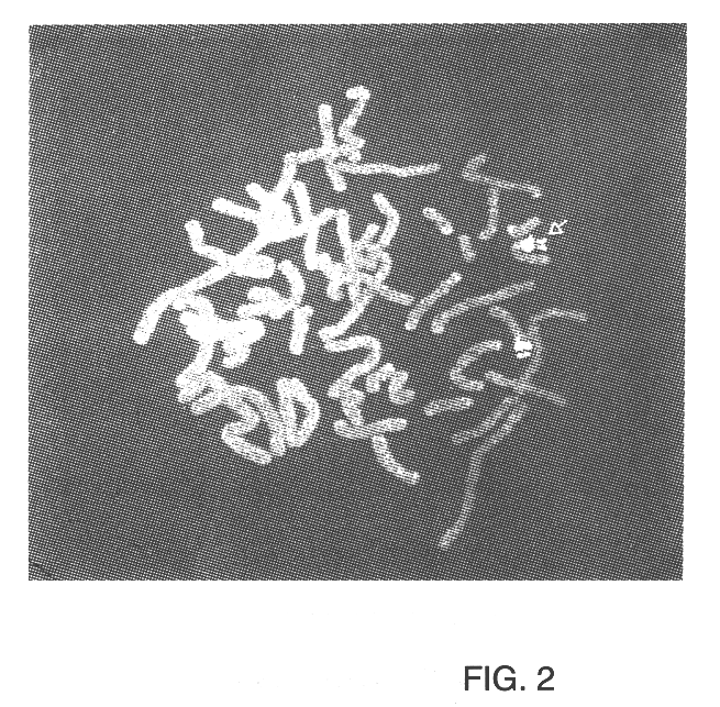 Polycystic kidney disease 1 gene and uses thereof