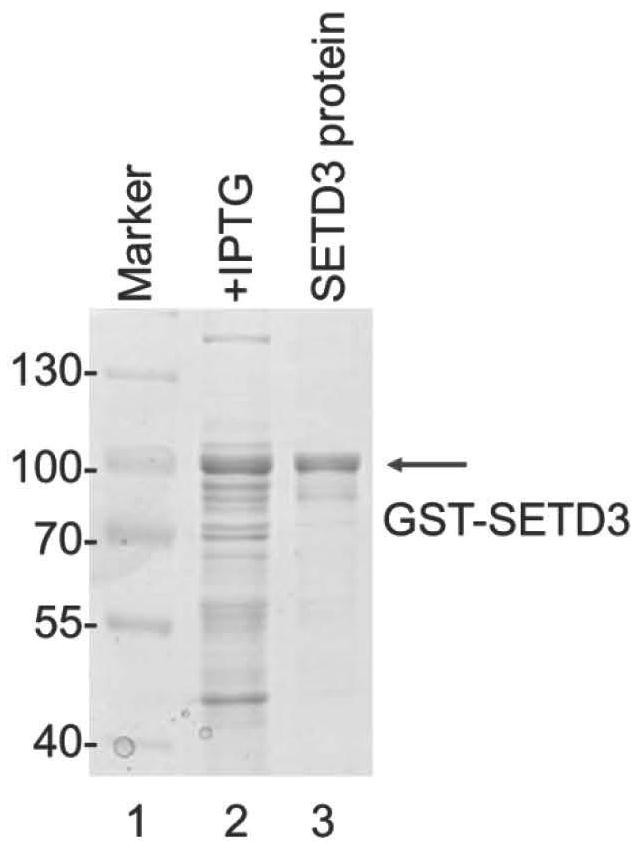 Anti-setd3 monoclonal antibody and use thereof