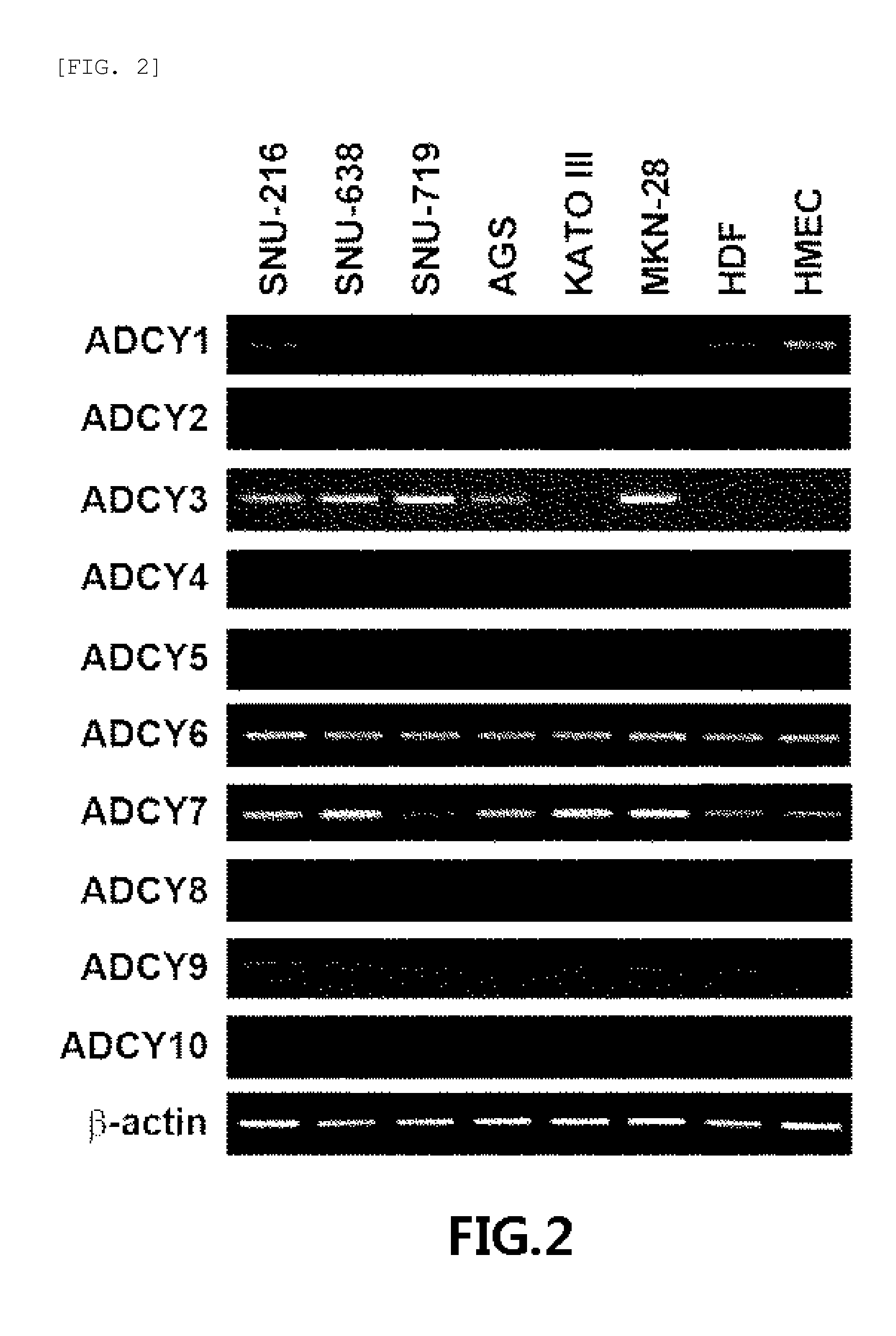 Use of adcy3 for diagnosis and treatment of gastric cancer