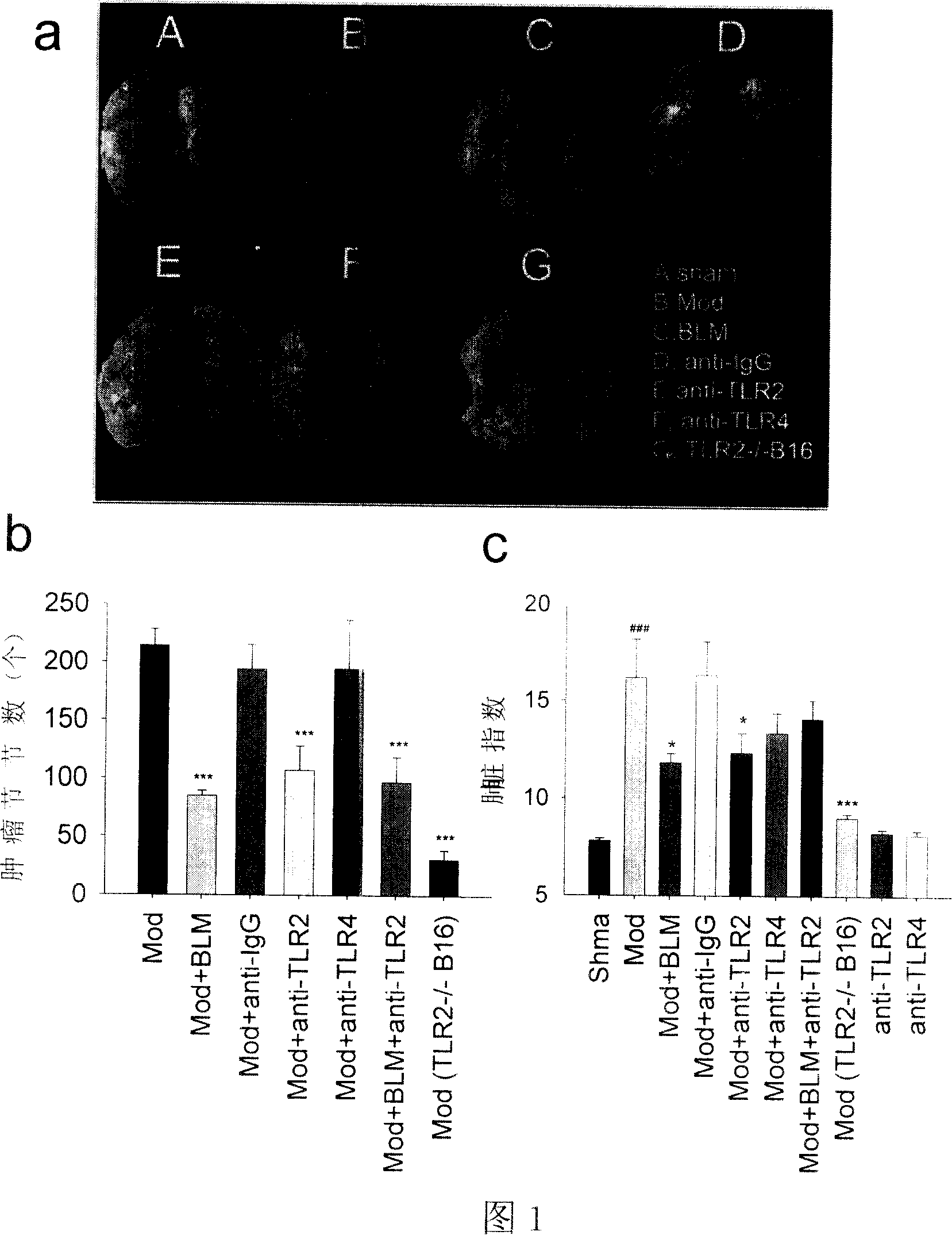 Anti Toll-like receptor 2 antibody inhibiting tumor metastasis use