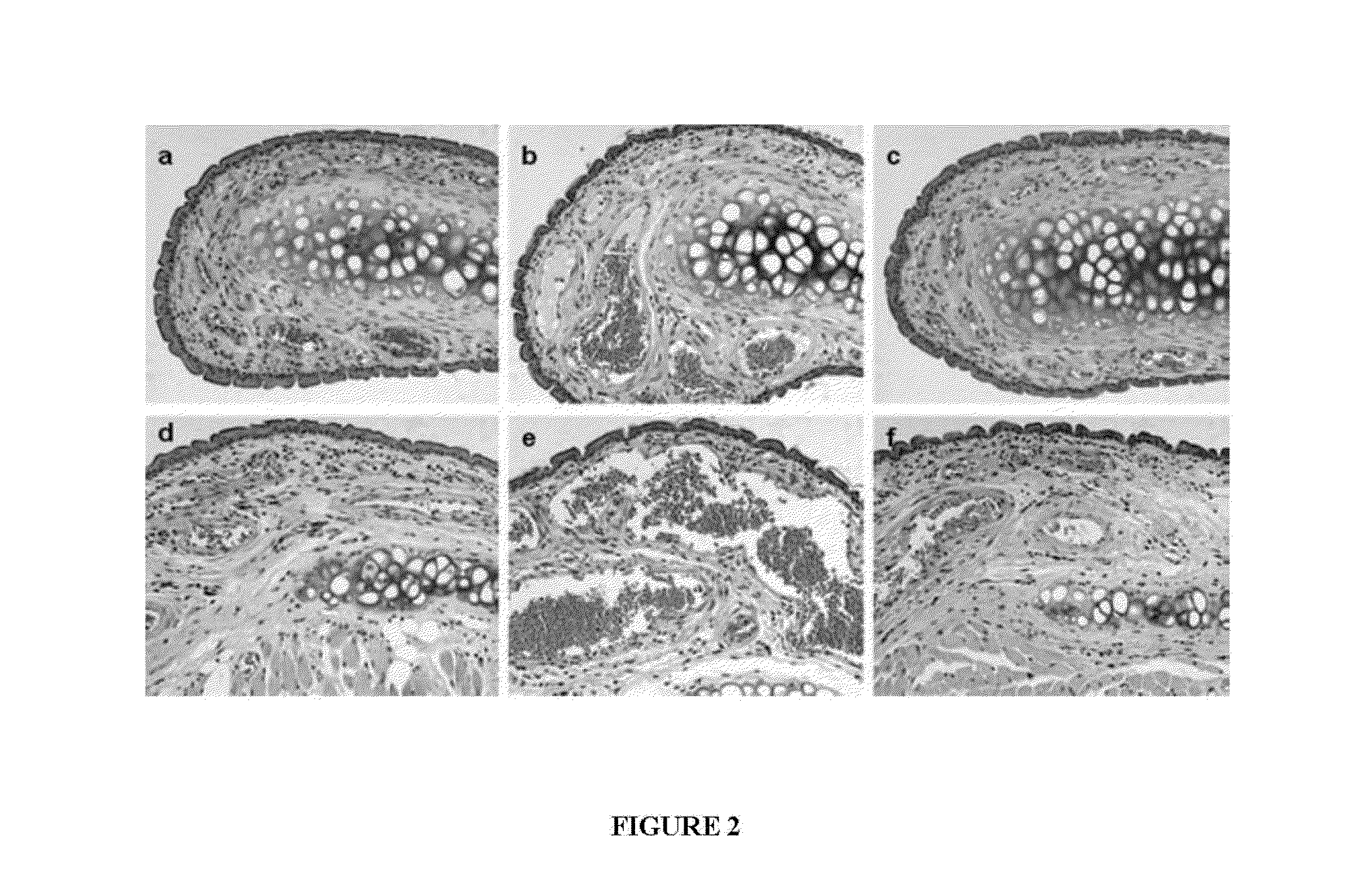 Compositions and Methods for Safe Treatment of Rhinitis