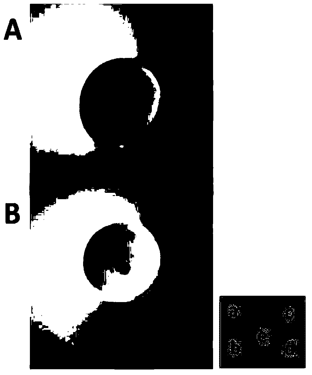 Application of lipopolysaccharide extracted from brucella ovis vaccine strain M5 in preparation of product for diagnosing human brucellosis