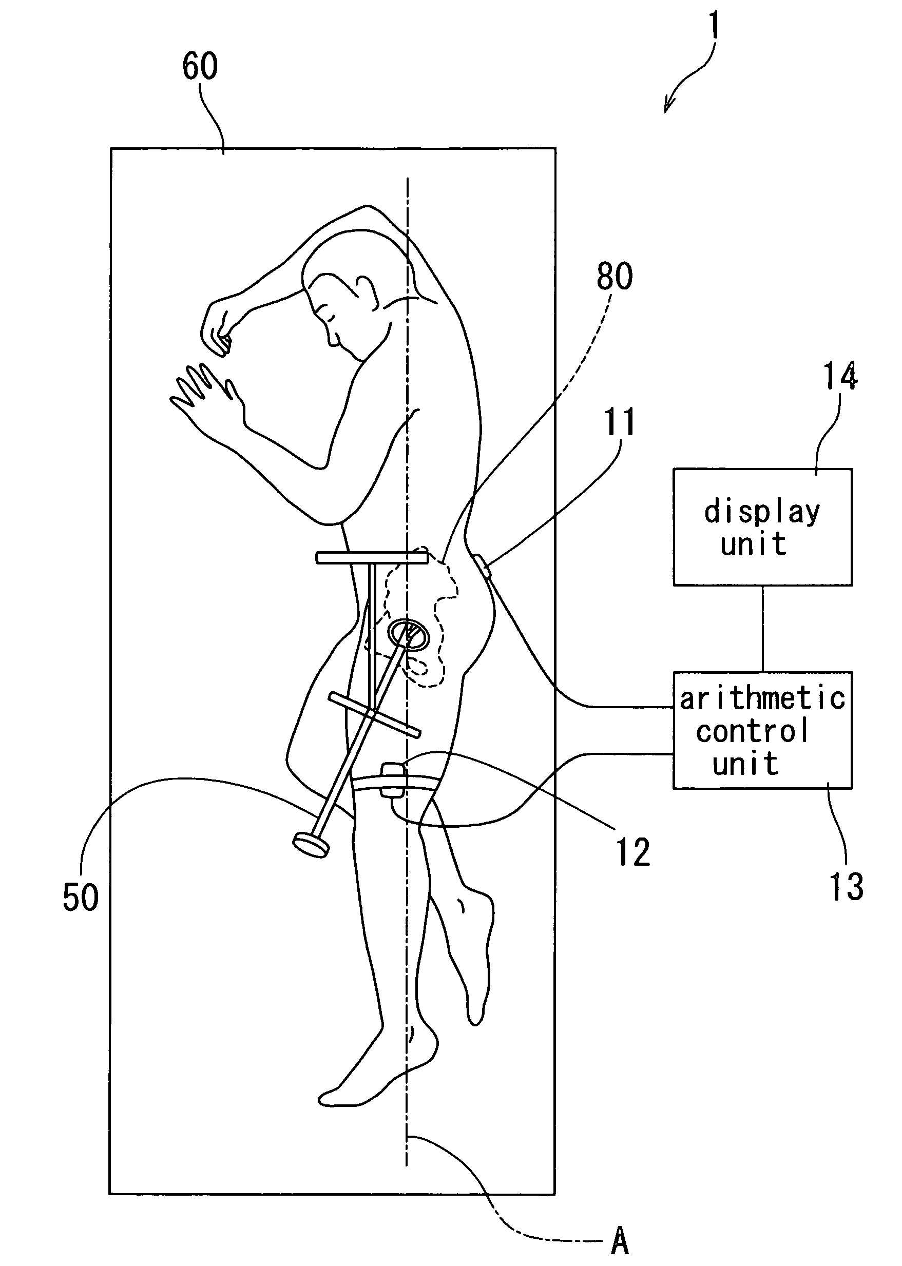 Operation assisting system