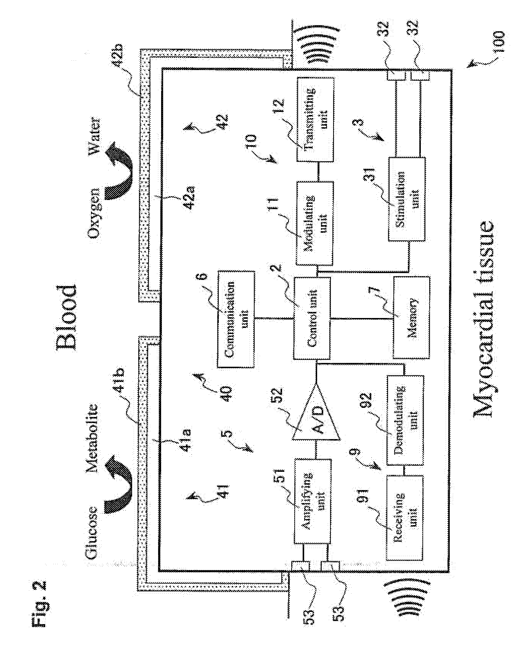 Cardiac pacing system and distributed cardiac pacing system