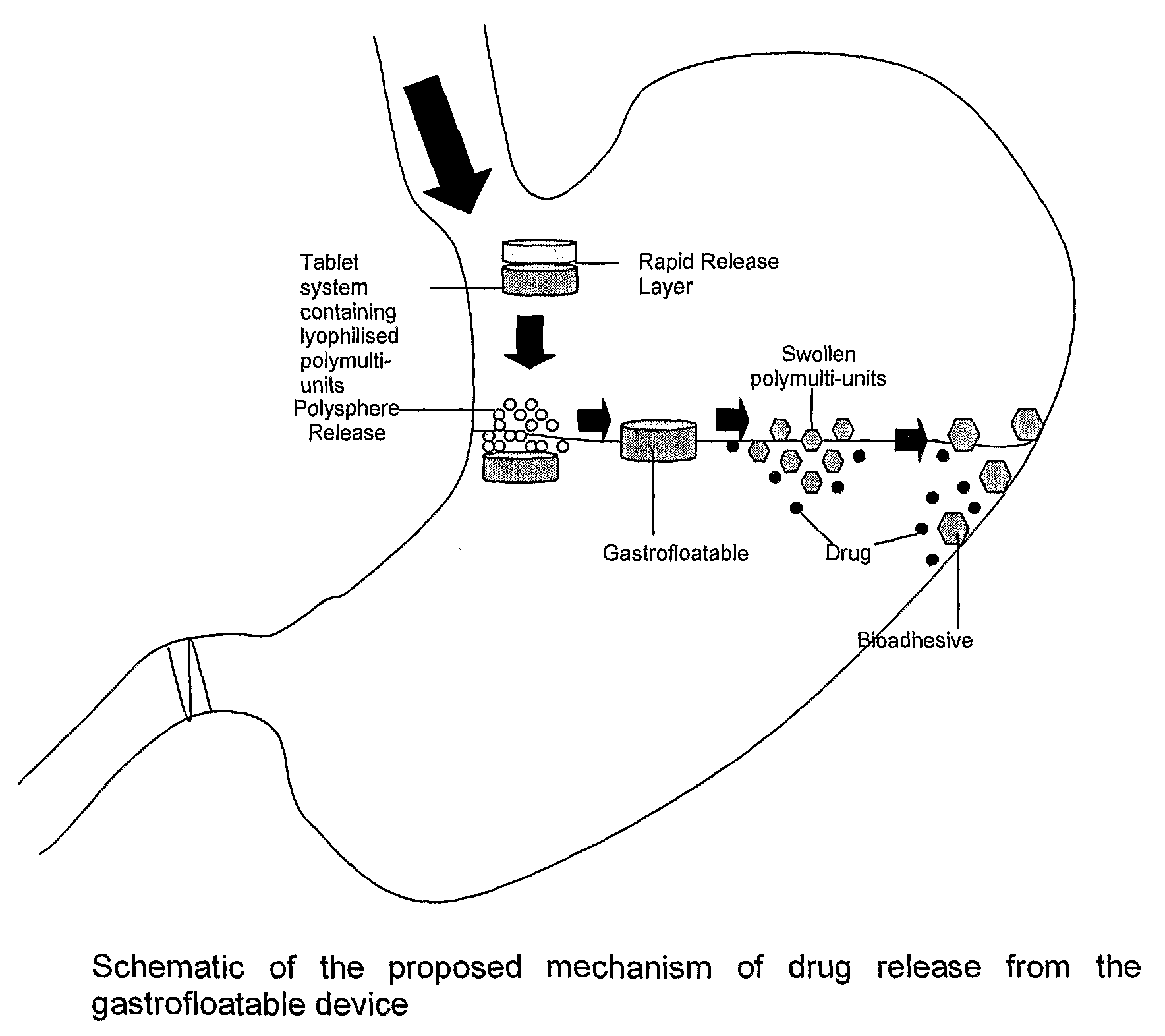 Multi-unit gastroretentive pharmaceutical dosage form comprising microparticles