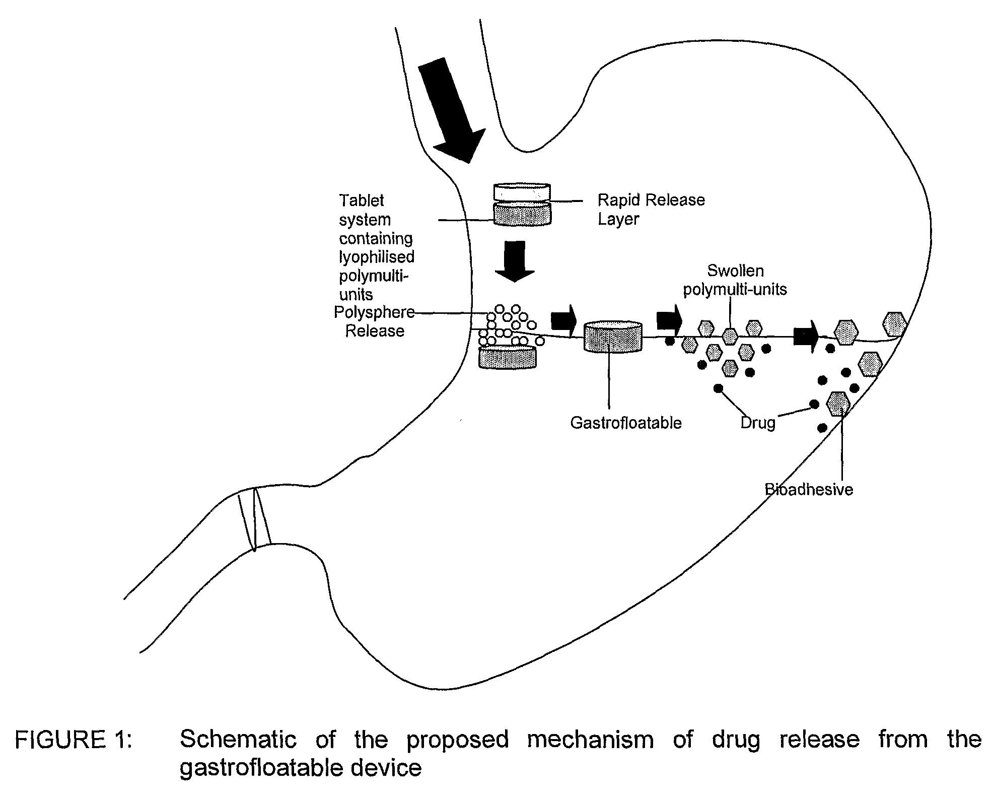 Multi-unit gastroretentive pharmaceutical dosage form comprising microparticles