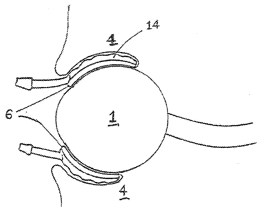 Medical device and method for temperature control and treatment of the eye and surrounding tissues