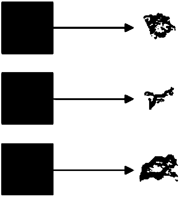 Pulmonary nodule benignity and malignancy detection method based on feature-fusion convolutional neural network