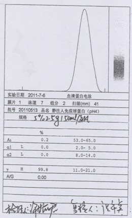 Process for preparing human immunoglobulin for intravenous injection