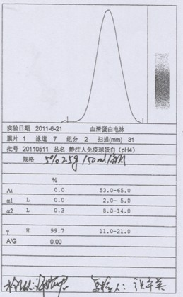 Process for preparing human immunoglobulin for intravenous injection