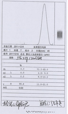 Process for preparing human immunoglobulin for intravenous injection