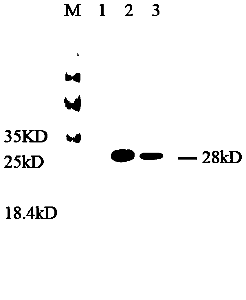 Detection kit for TIMP-I latex enhanced turbidimetry and preparation and using method thereof