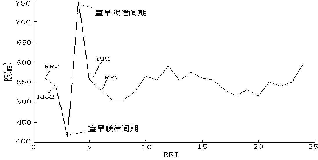 Heart rate turbulence tendency extraction method based on cloud model and scatter diagram