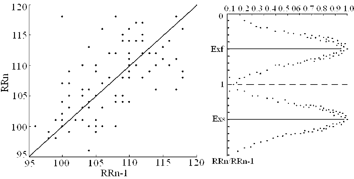 Heart rate turbulence tendency extraction method based on cloud model and scatter diagram