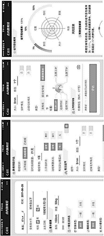 Method and system for assisting in screening lung cancer based on artificial intelligence