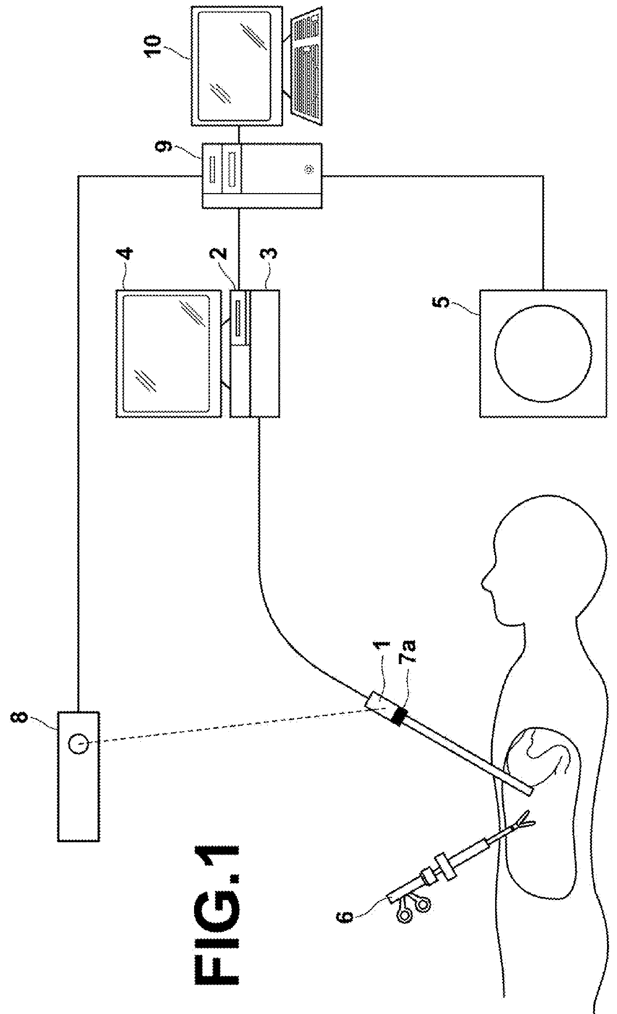 Endoscopic observation support system