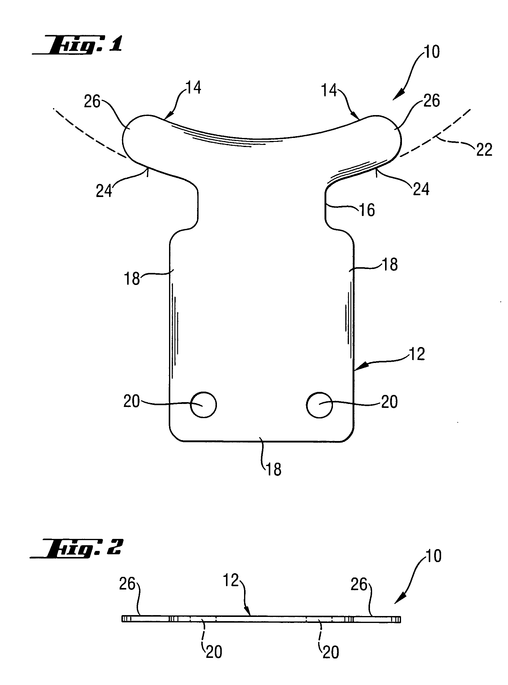 Article and method for ocular aqueous drainage