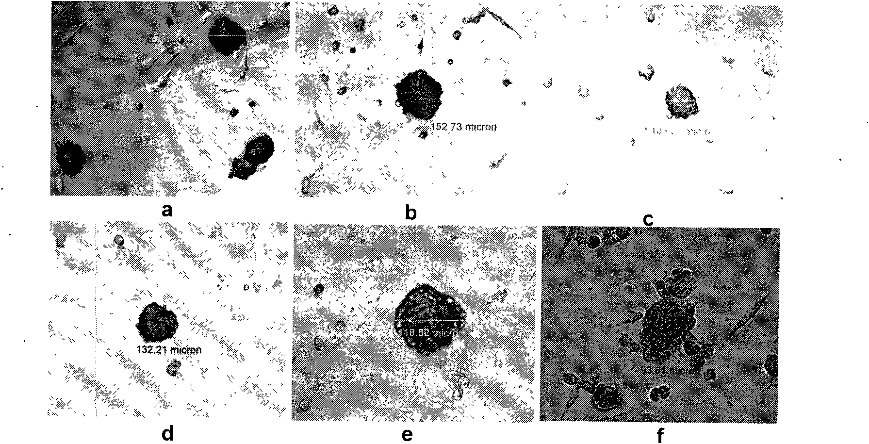 Method for inducing in vitro human medulla mesenchymal stem cells to be divided into islet-like cells