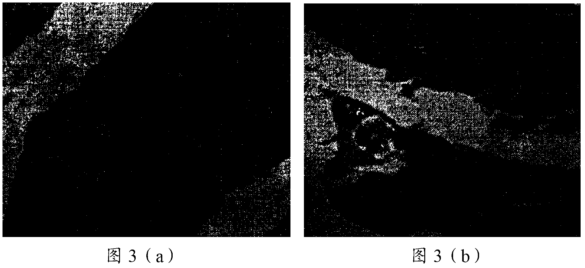 Thymalfasin in-situ gel preparation and preparation method thereof