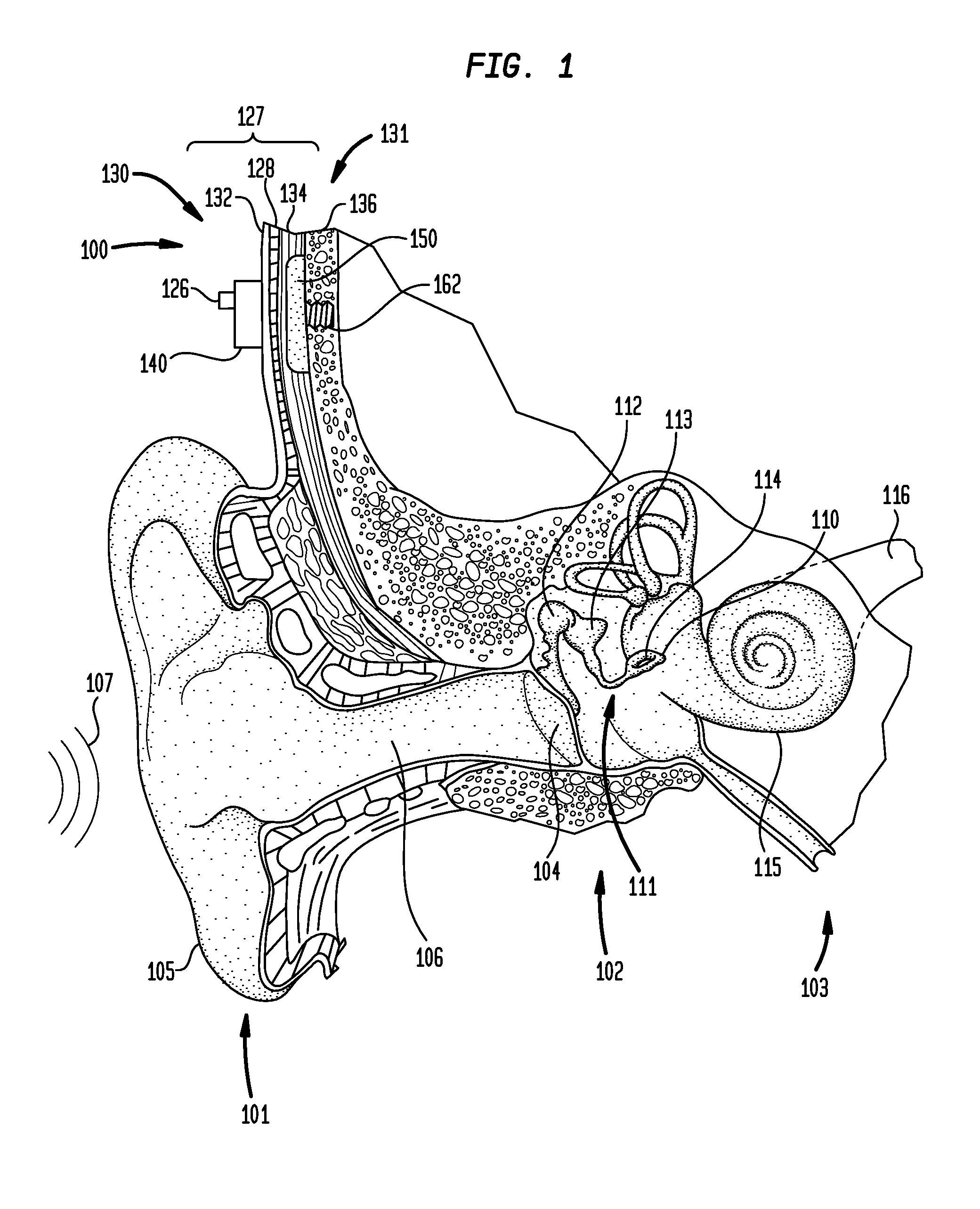 Transcutaneous bone conduction device vibrator having movable magnetic mass