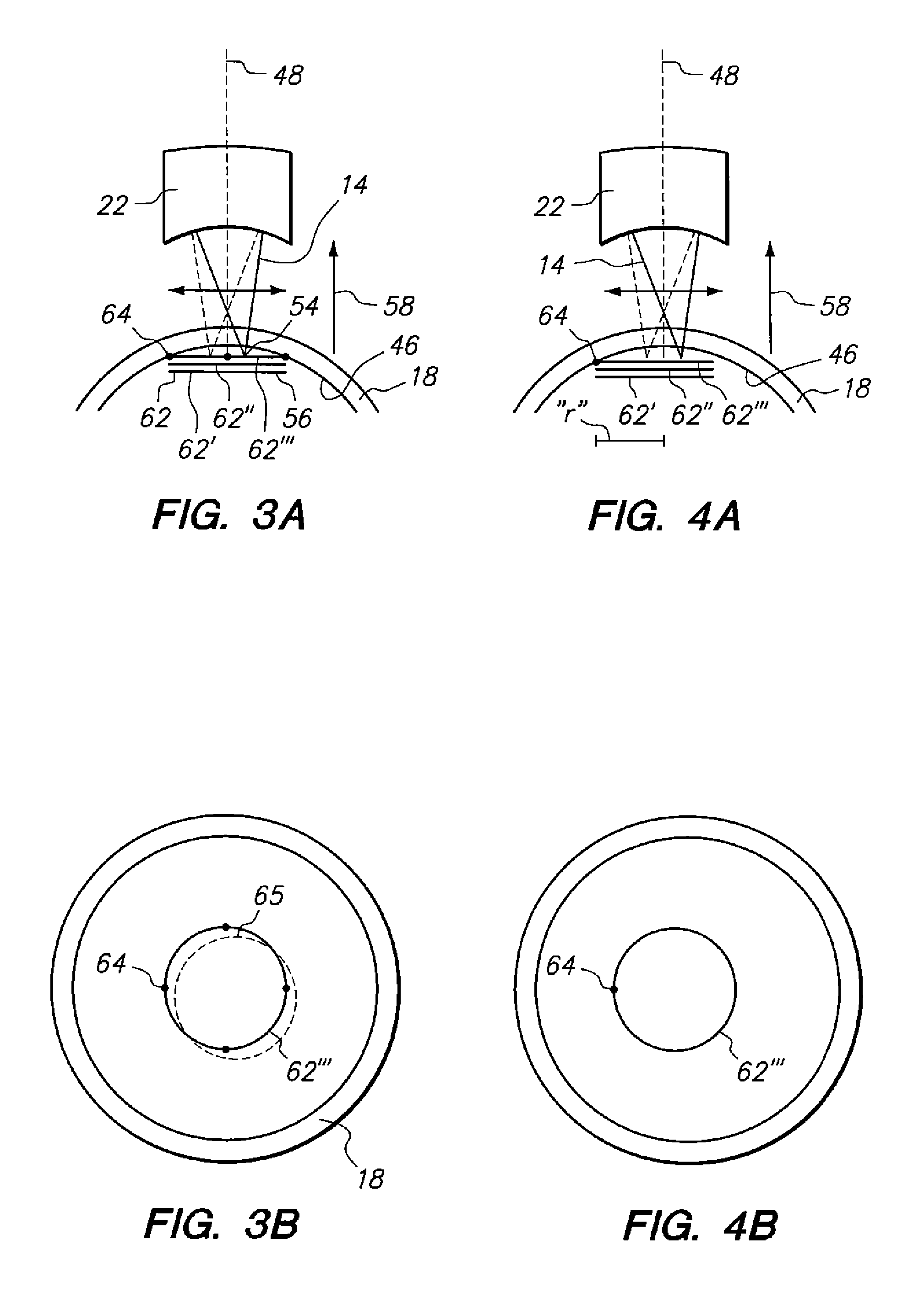 Device and method for calibrating a laser system