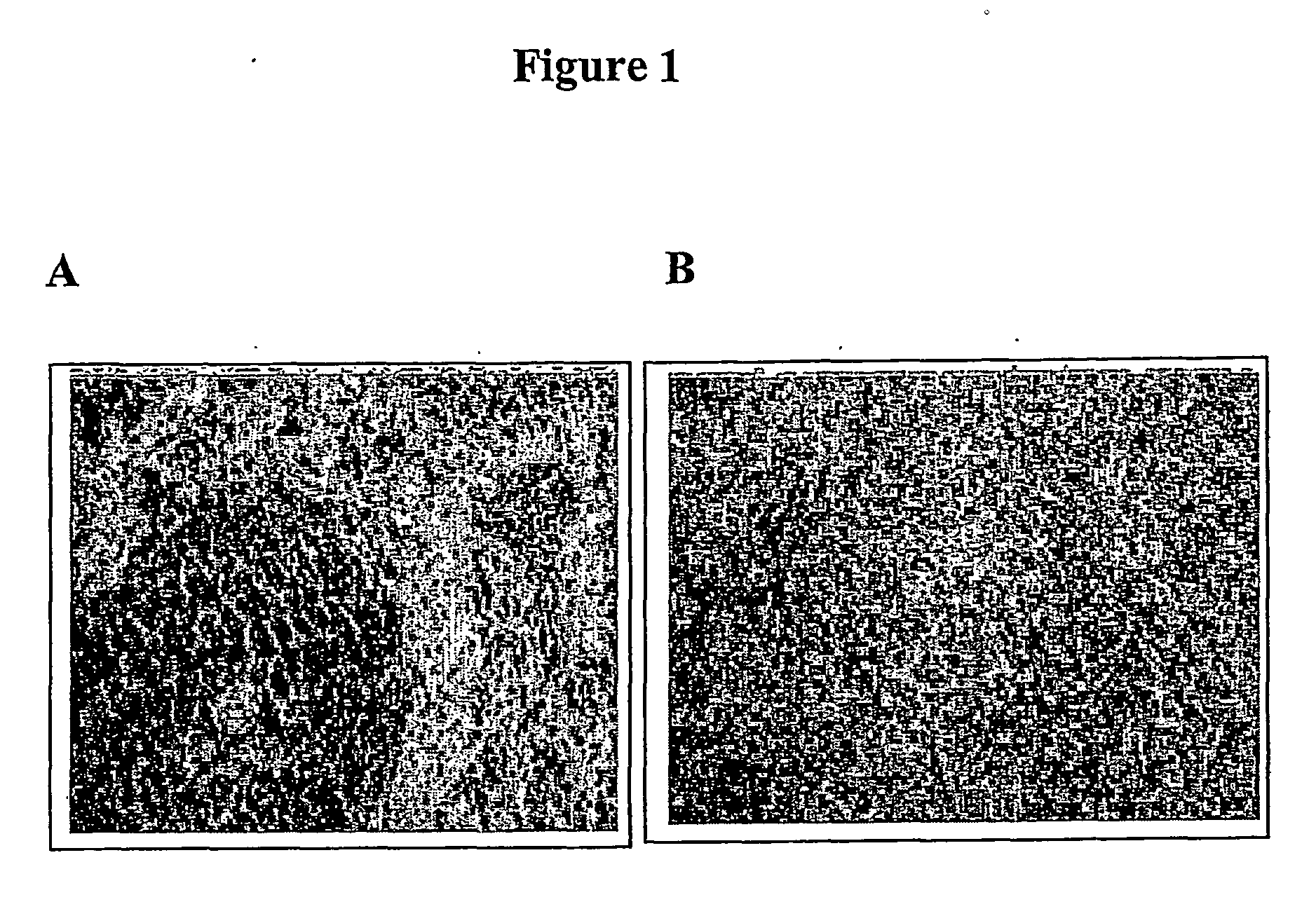 Preparation And Composition Of Inter-Alpha Inhibitor Proteins From Human Plasma For Therapeutic Use