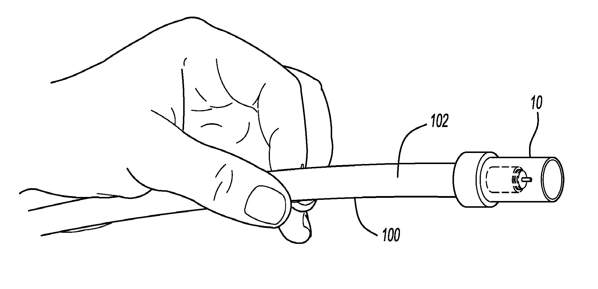 Device for endoscopic treatment of upper gastrointestinal bleeding