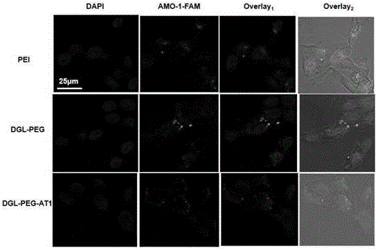 Nano microRNA precise diagnosis and treatment system capable of targeting ischemic myocardium