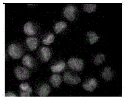 Preparation method and application of a kind of Dictyophora polysaccharide-zinc chelate with anti-tumor activity