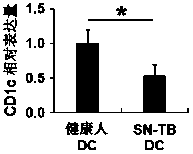 Application of cd1c in the diagnosis of bacterial-negative pulmonary tuberculosis