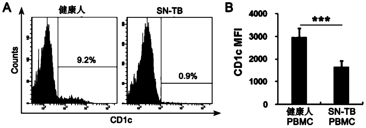 Application of cd1c in the diagnosis of bacterial-negative pulmonary tuberculosis