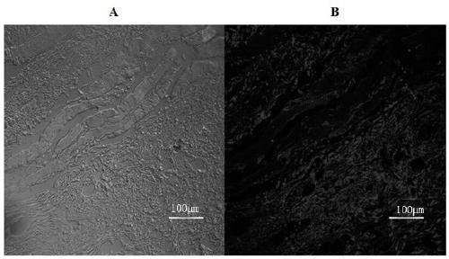 A nucleic acid aptamer-based immunofluorescence kit for pulmonary metastatic osteosarcoma tissue