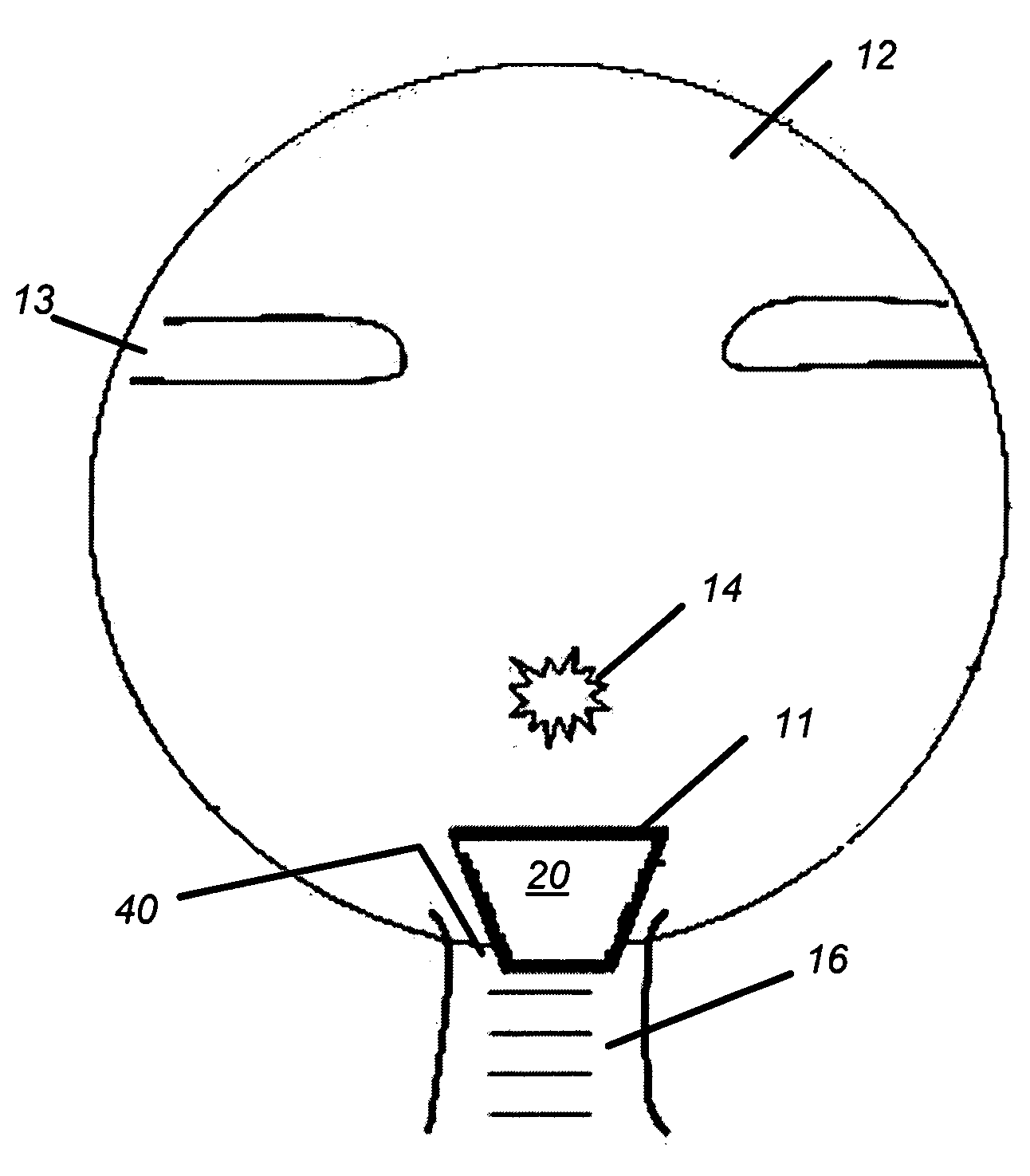 Optic nerve head implant and medication delivery system