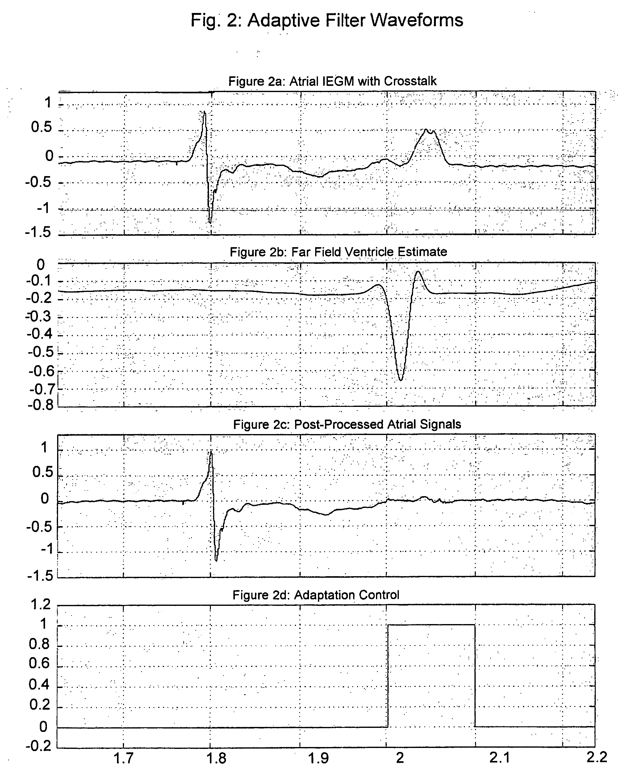 Method and apparatus for deducing far-field interchamber interference in an implanted medical device