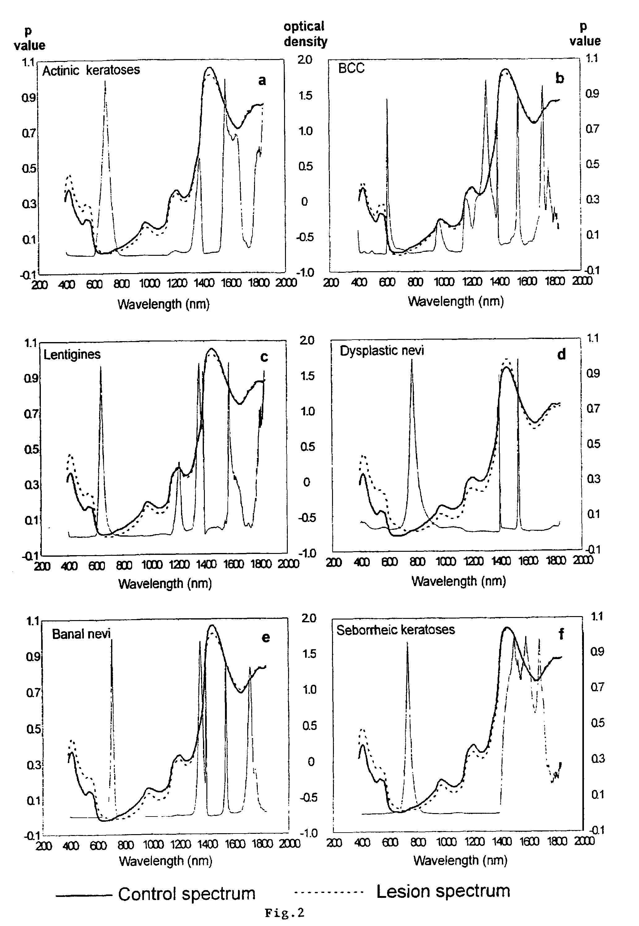 Non-invasive screening of skin diseases by visible/near-infrared spectroscopy