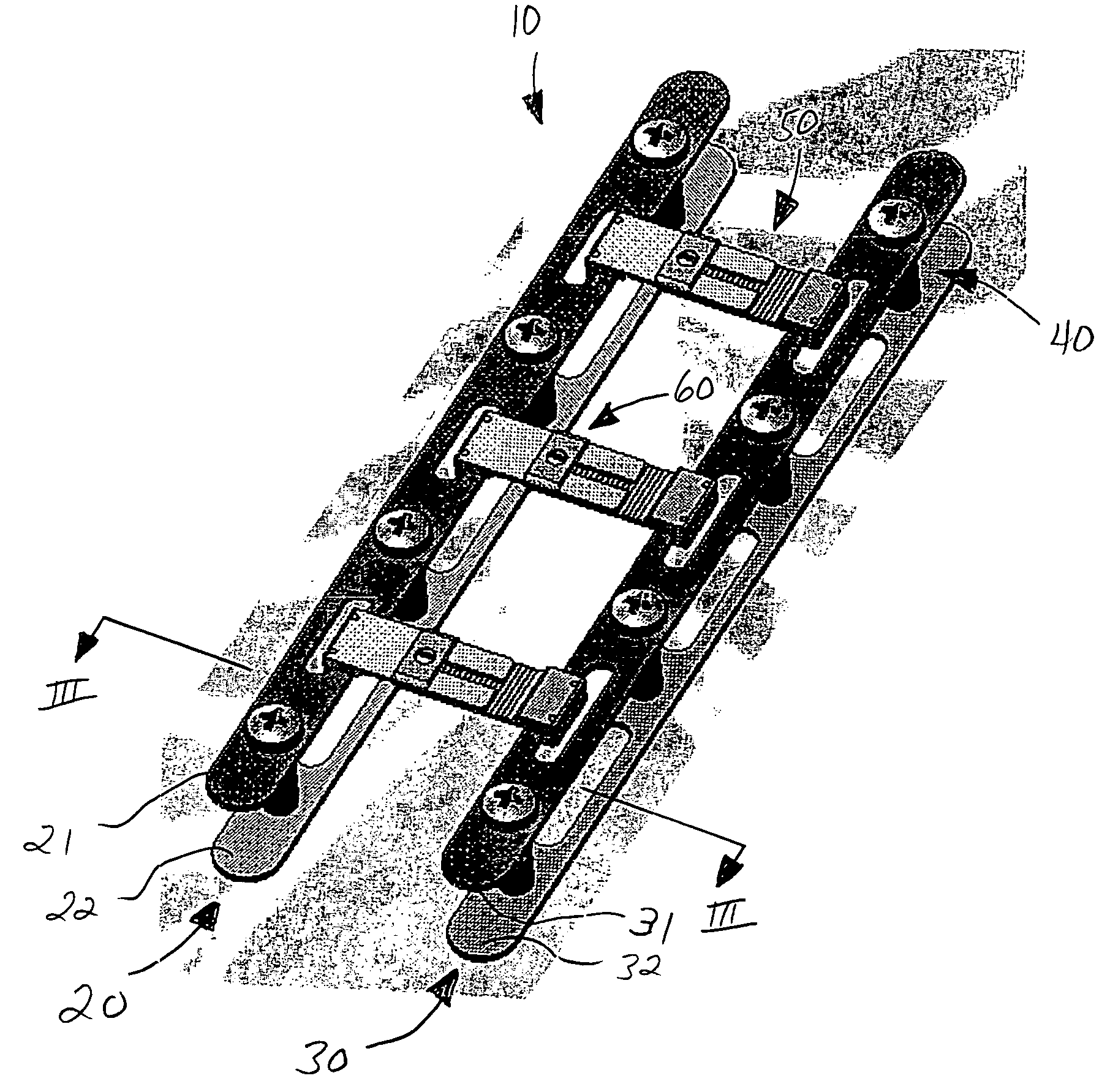 Sternal closure device