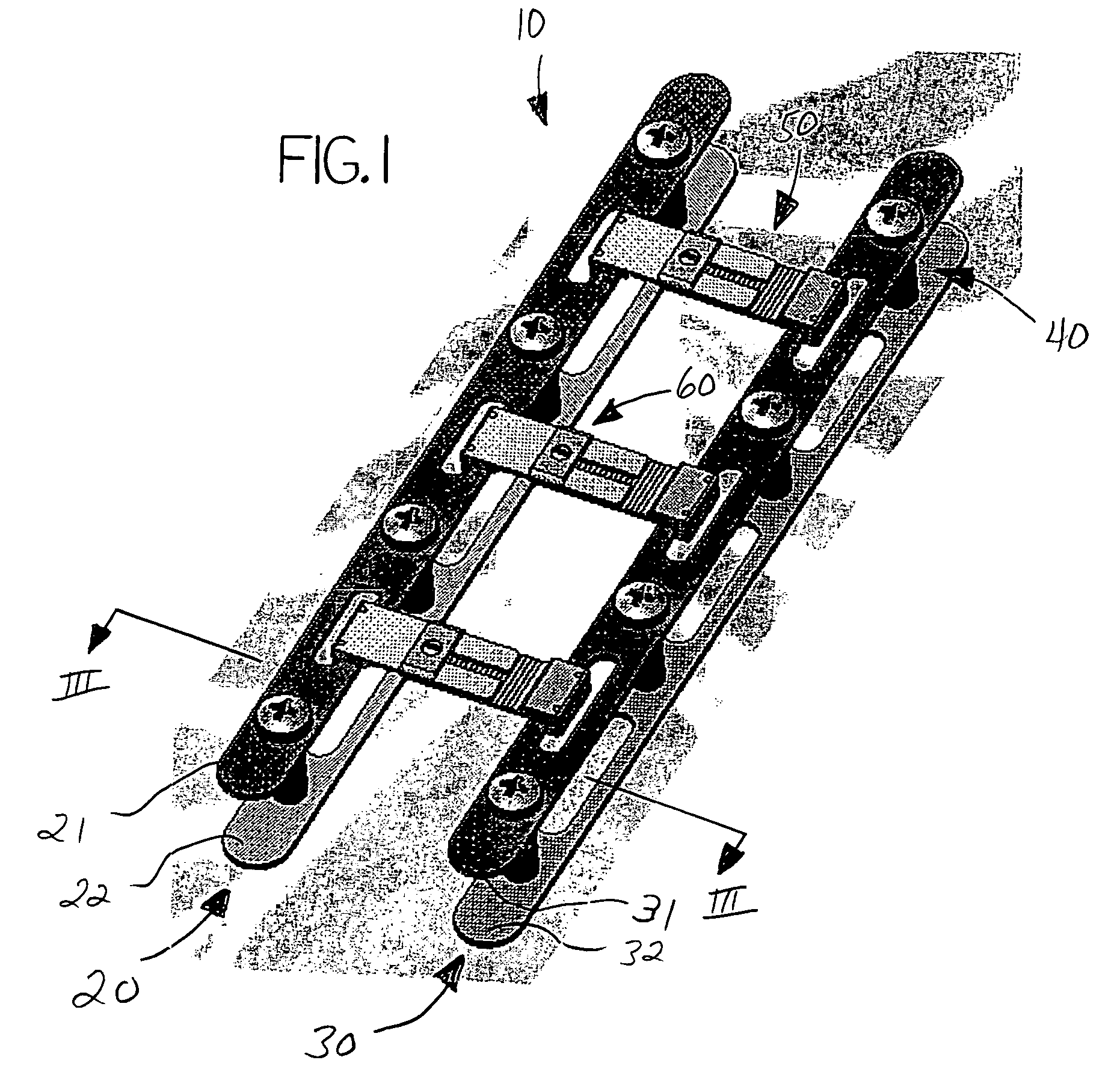 Sternal closure device