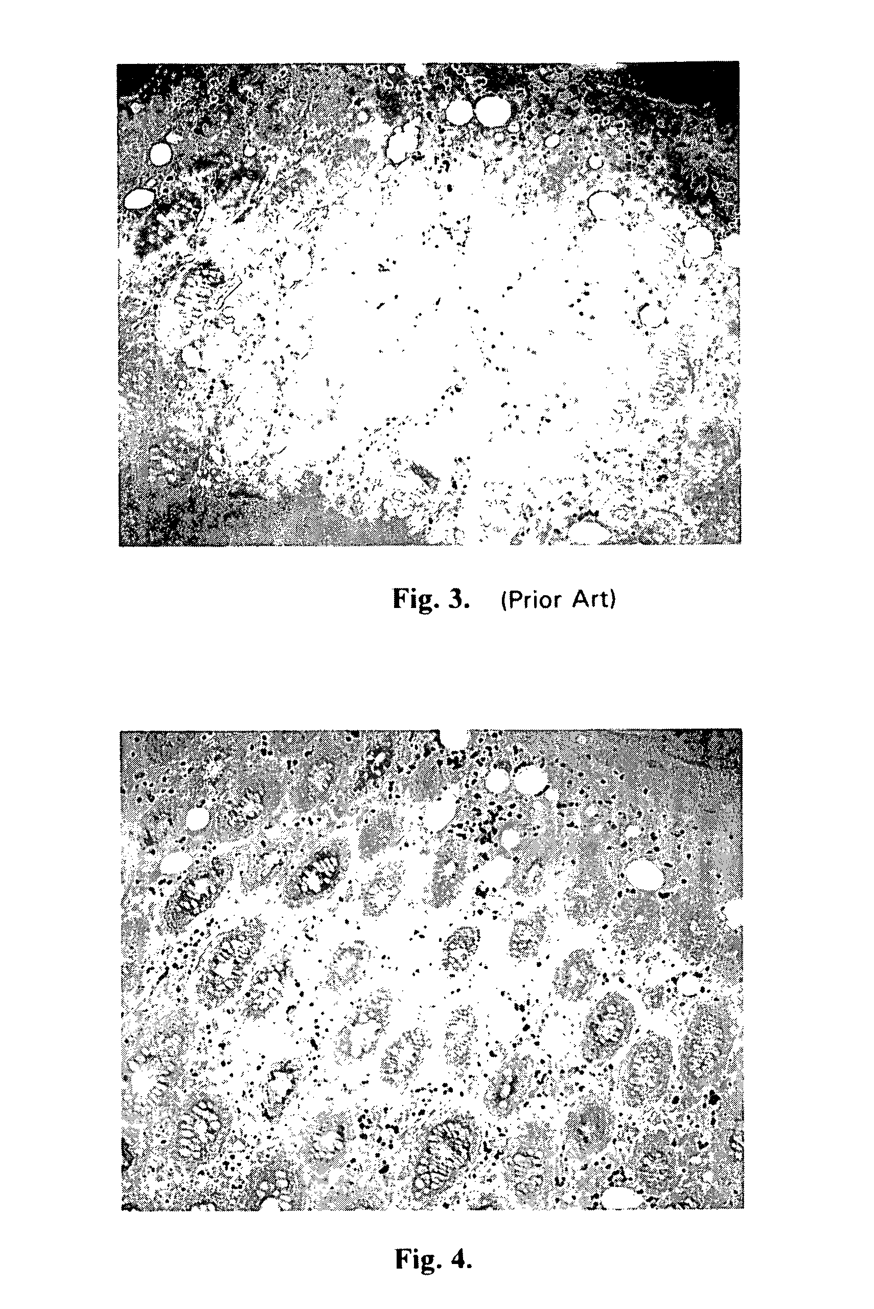 Test methods using enzymatic deposition and alteration of metals