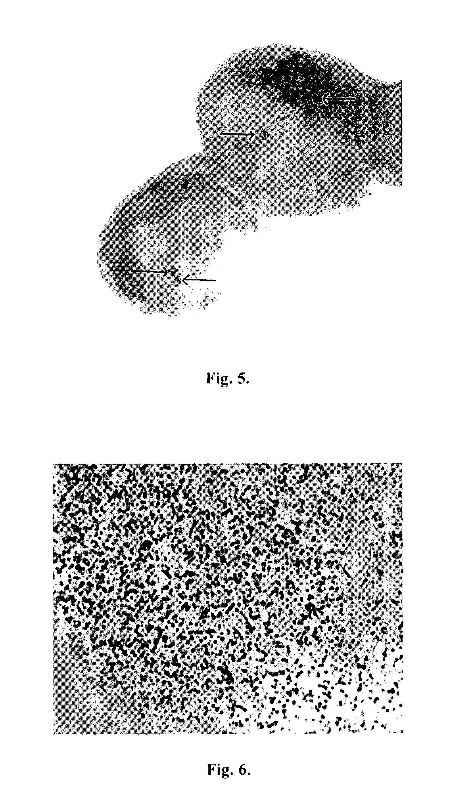 Test methods using enzymatic deposition and alteration of metals