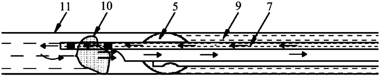 Suction catheter