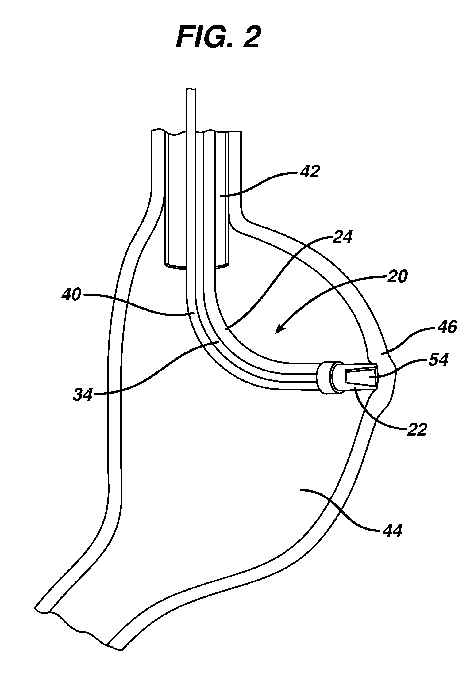 Device for plicating and fastening gastric tissue