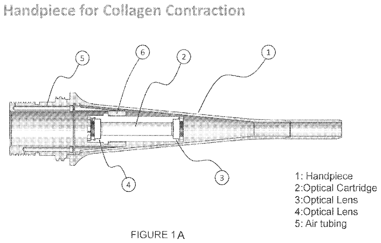 System and method for laser based treatment of soft tissue