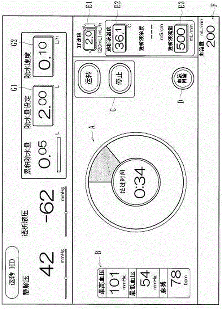 blood purification device