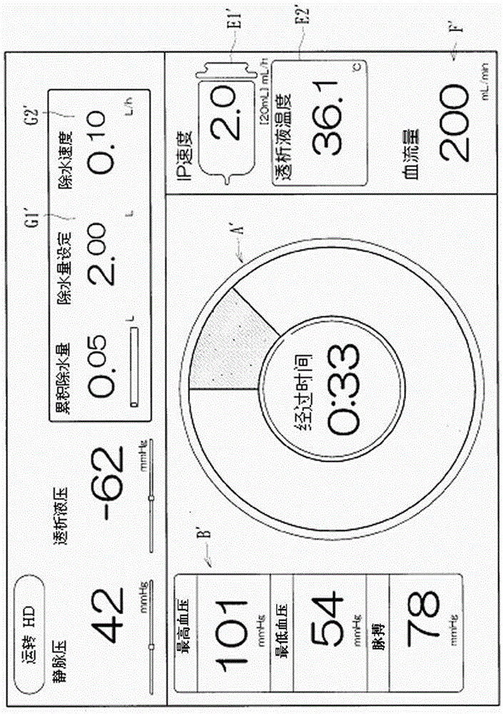 blood purification device