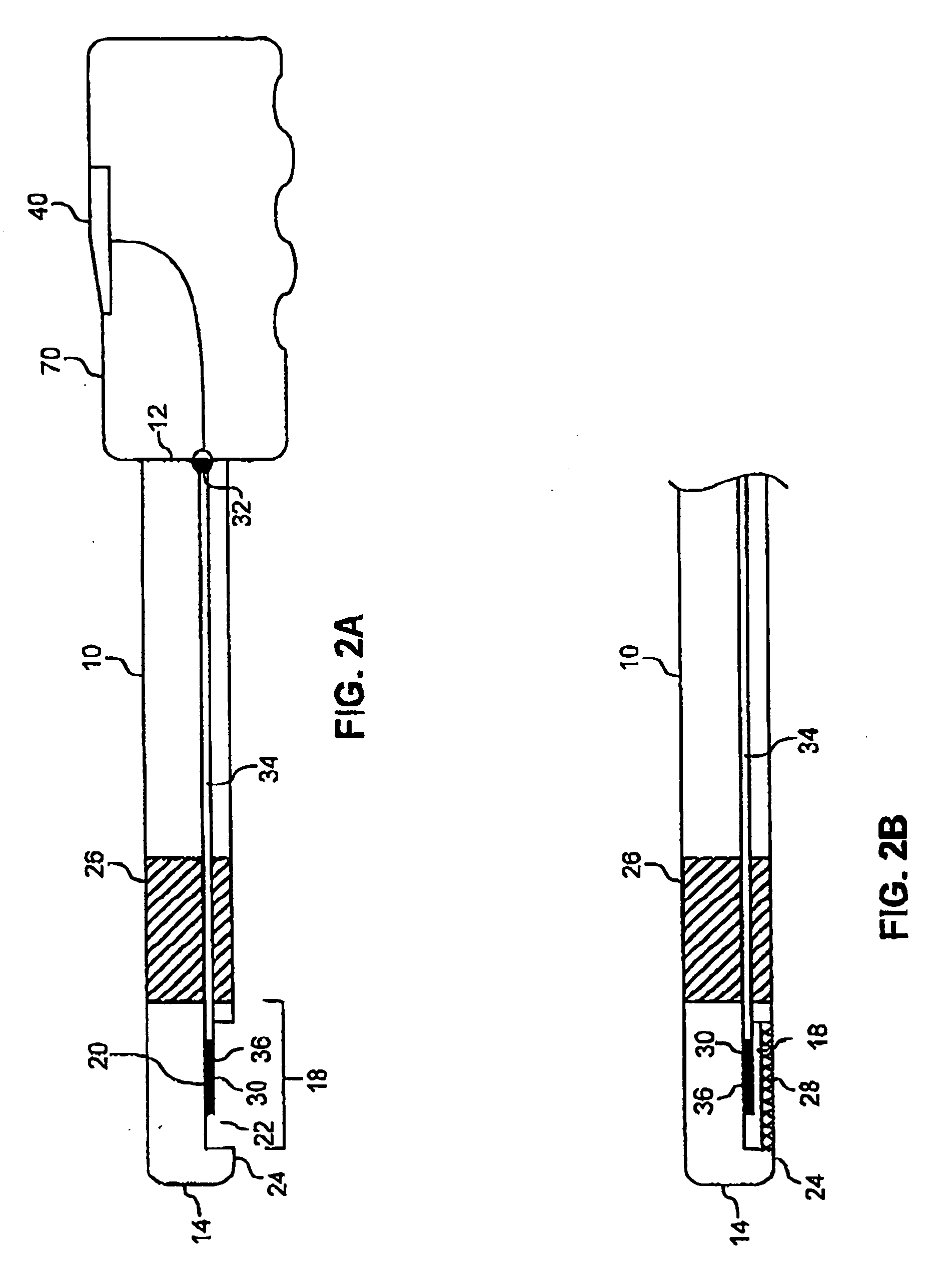 Noninvasive detection of a physiologic parameter with a probe