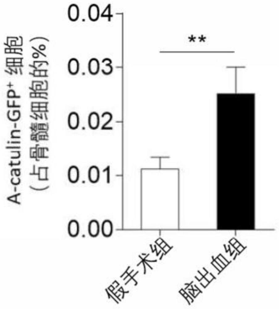 Application of beta 3-adrenergic receptor agonist in preparation of medicine for treating brain injury