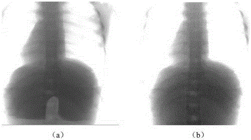 Method for eliminating image persistence of vision of flat panel detector and flat panel detector