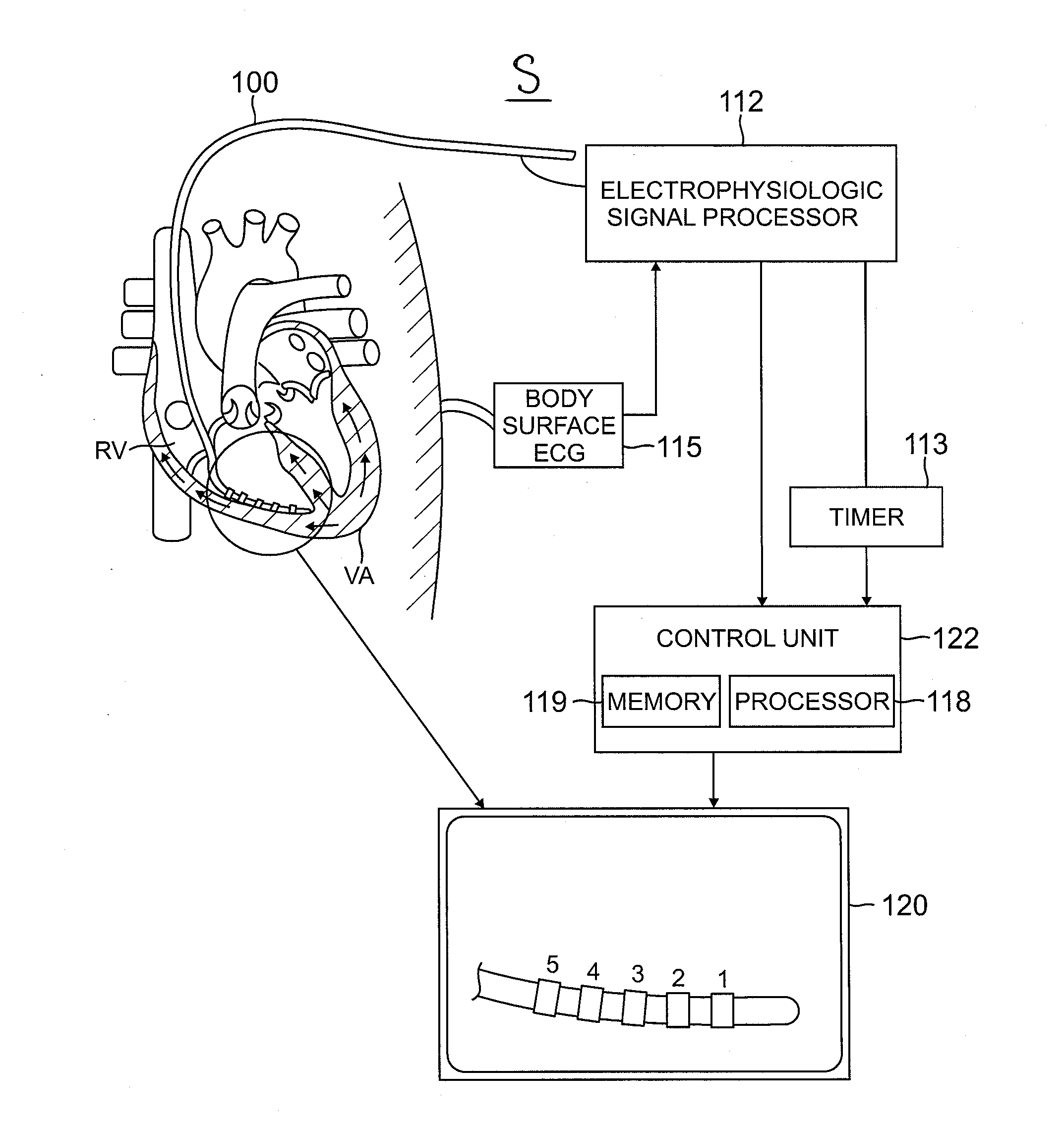 System and method for visualizing electrophysiology data